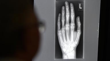 Röntgenbild einer Hand