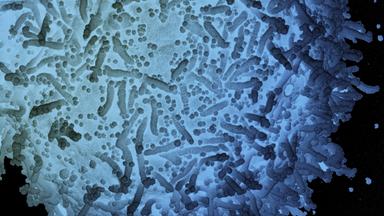 Mit SARS-CoV-2 infizierte Zelle, koloriert