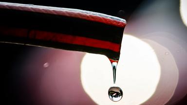 Wasser tropft aus einem Gartenschlauch