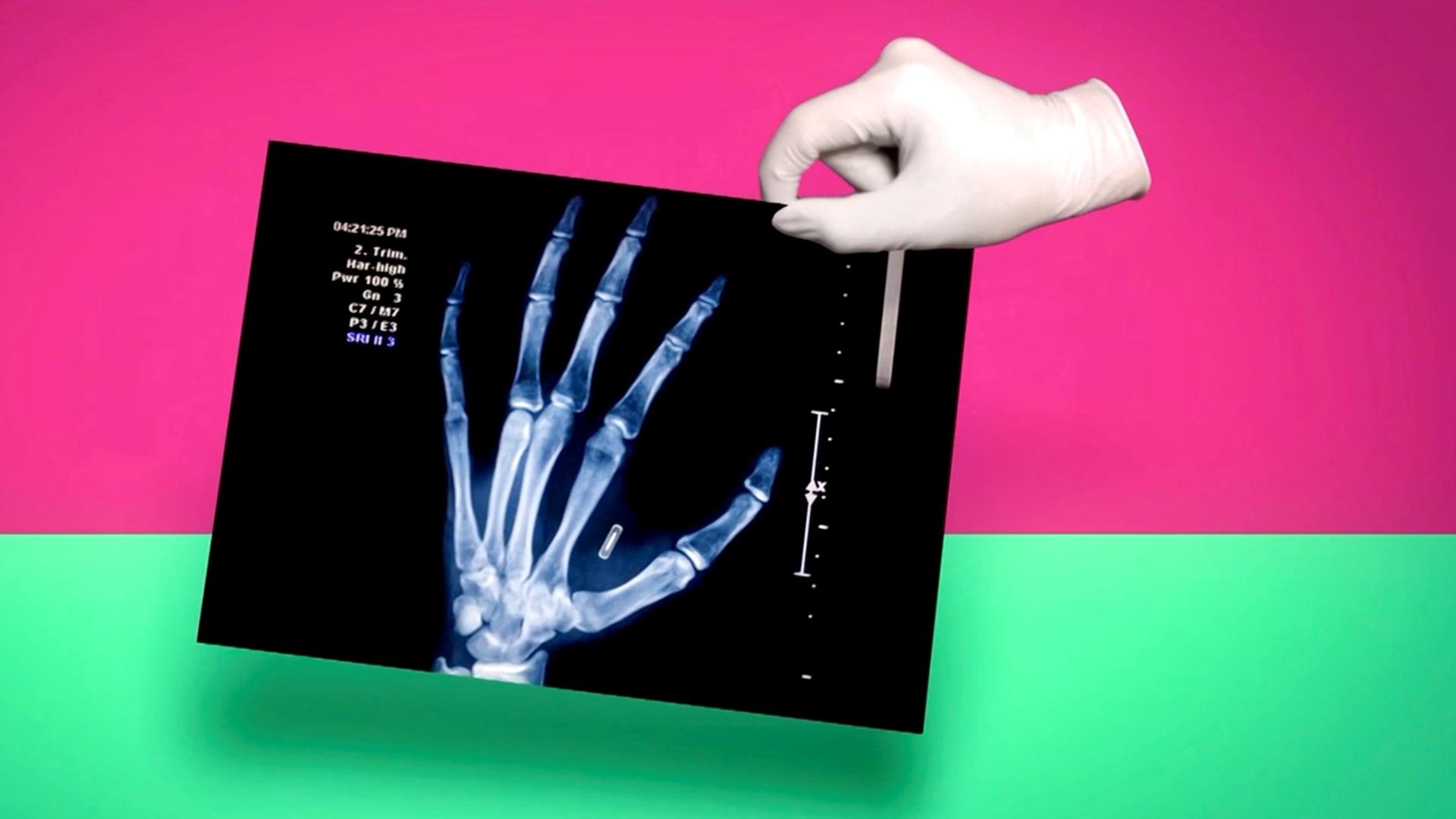 Animation Biohacking