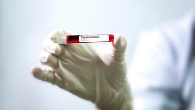 Probe mit Coronavirus