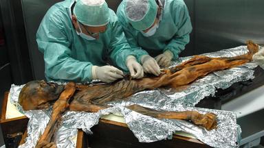 Gletschermann Ötzi wird untersucht