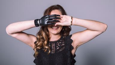 Eine Frau mit Armprothese posiert für ein Foto mit verschränkten Händen vor dem Gesicht.