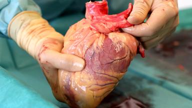Das menschliche Herz in Händen eines Chirurgen