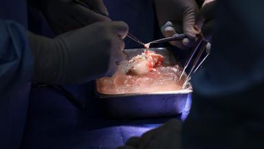 Szene einer Xenotransplantation
