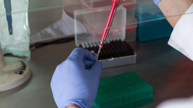 Laboruntersuchungen / Diagnostik von Blutproben