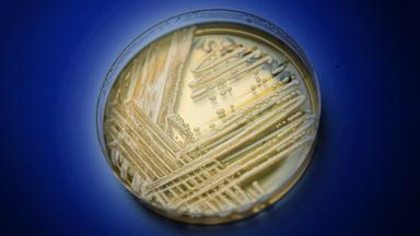 Der Hefepilz Candida auris in einer Petrischale, aufgenommen in einem Labor der Universität in Würzburg.