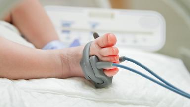 Fuß eines Baby angeschlossen an medizinische Überwachung