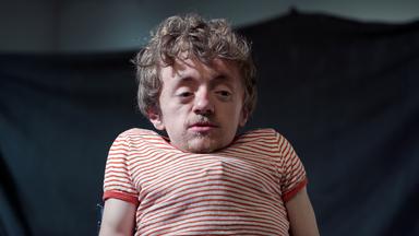 Leonard, ein kleinwüchsiger junger Mann, trägt ein rotgestreiftes T-Shirt.