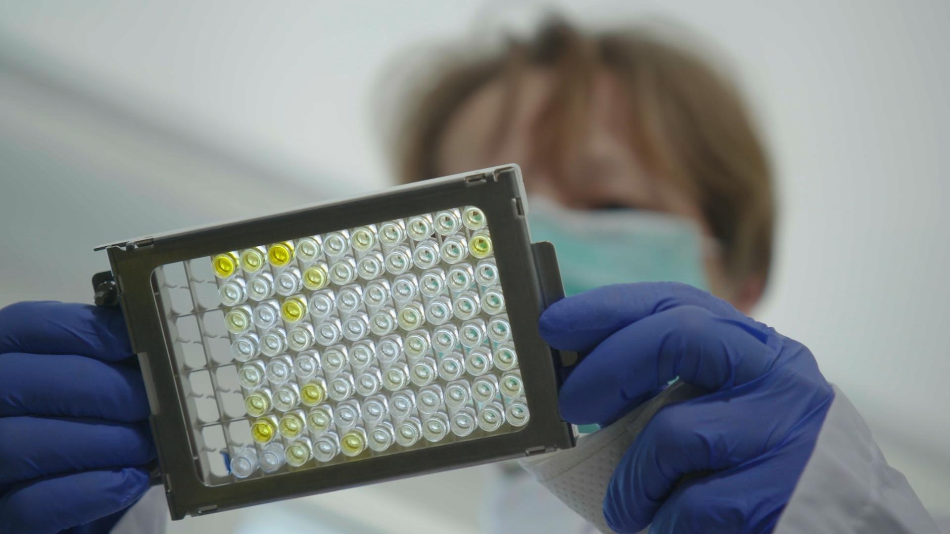 Labortechnikerin hält Proben in der Hand.