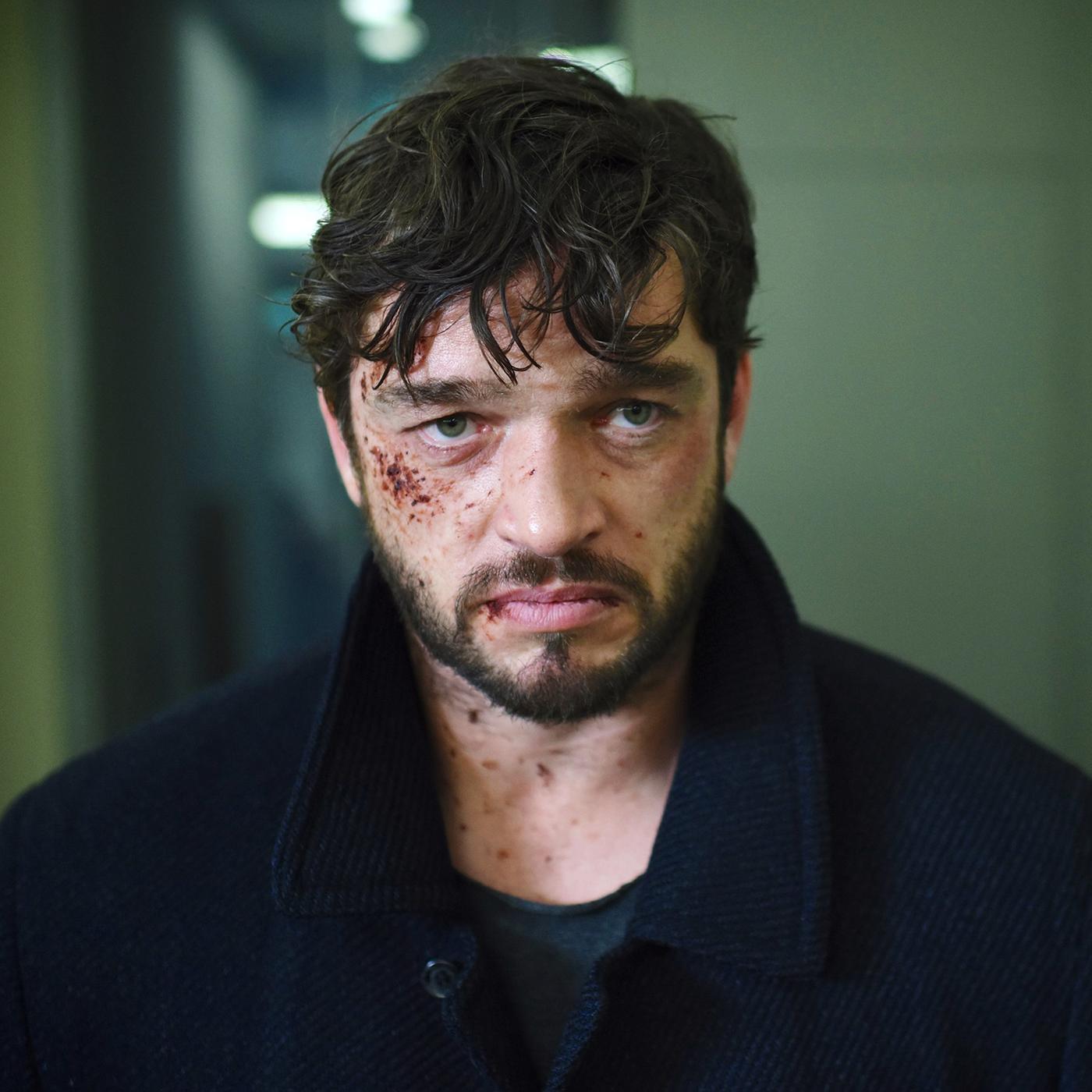 Blutverschmiertes Gesicht eines bärtigen Mannes.