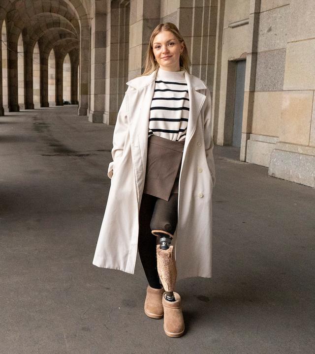 Anna Osicki zeigt ihre Prothese