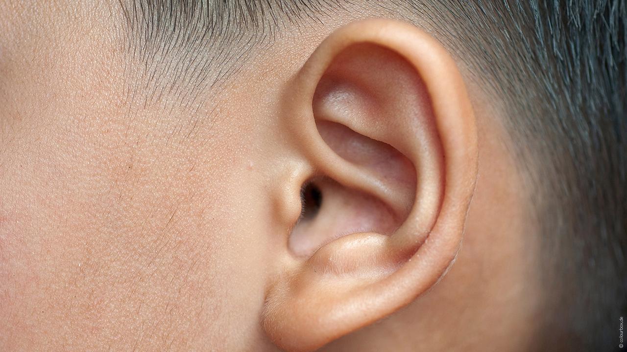 уши разной длины. лопоухость до и после операции. собранная прическа при лопоухости.