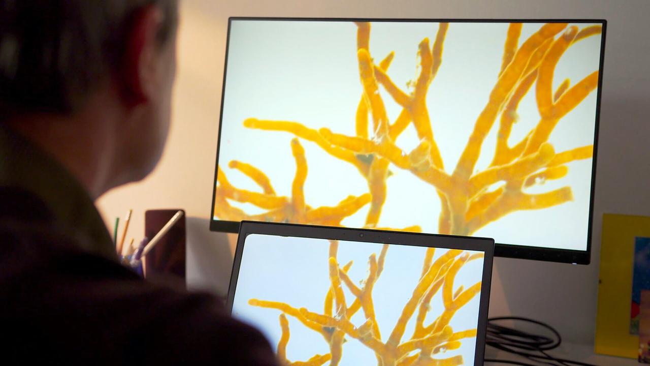 Das Bild zeigt eine Nahaufnahme von zwei Monitoren, die beide dieselbe Darstellung zeigen. Auf den Bildschirmen sind leuchtend orangefarbene, verzweigte Strukturen zu erkennen, die mikroskopisch kleine Mykorrhiza-Pilze darstellen. Diese Pilzstrukturen sehen aus wie ein Netzwerk von Ästen oder Zweigen und illustrieren das Konzept des "Wood-Wide Web", das den Austausch von Nährstoffen und Informationen zwischen Bäumen beschreibt. Im Vordergrund ist der Kopf und ein Teil des Oberkörpers eines Mannes zu sehen, der von hinten zur Kamera schaut und sich auf die Monitore konzentriert. Der Raum wirkt hell und modern, mit verschiedenen Büromaterialien, wie Stiften, die in einem Behälter auf dem Tisch stehen.