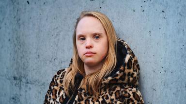 Eine junge Frau mit Down-Syndrom lehnt an einer grauen Wand.