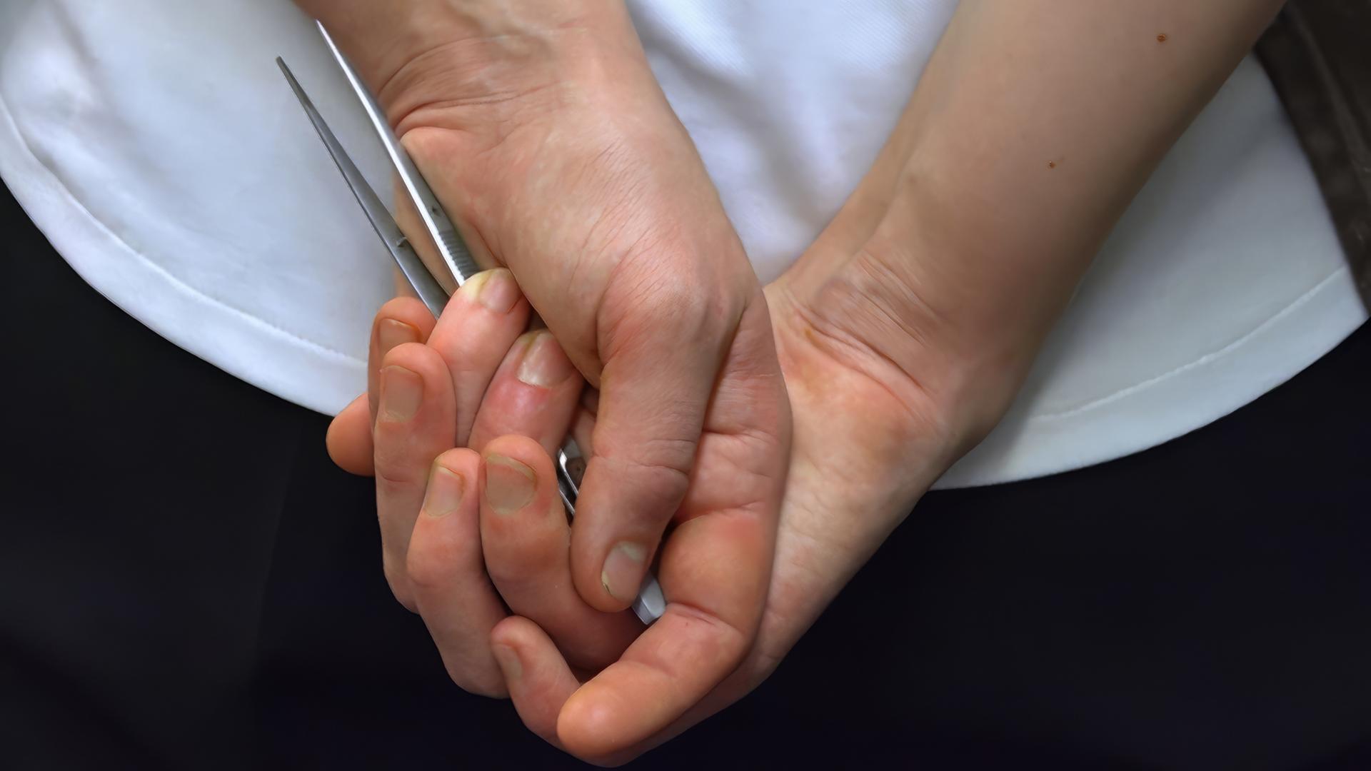 Zwei Hände halten eine Pinzette.