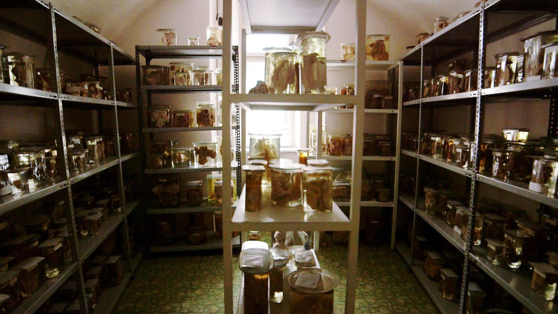 Über 50.000 Humanpräparaten birgt die pathologisch-anatomische Sammlung, die größte der Welt